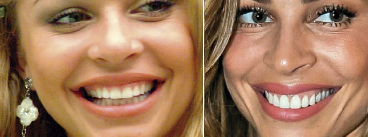 O “antes e o depois” na publicidade de dentistas