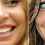 O “antes e o depois” na publicidade de dentistas